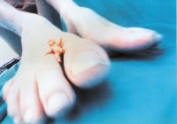 Pickelporno, Pipilotti Rist, 1992